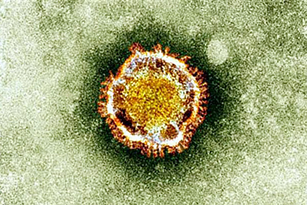 Coronavirus &quot;2019-nCoV&quot; sous le microscope. (Image : ET)